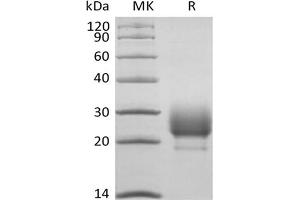 Western Blotting (WB) image for CD79b Molecule, Immunoglobulin-Associated beta (CD79B) protein (His tag) (ABIN7321037) (CD79b Protein (His tag))