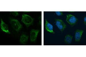 Immunofluorescence (IF) image for anti-Complement Component 3 (C3) (C-Term) antibody (ABIN2855007)