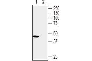 Western blot analysis of rat heart membrane: - 1. (Presenilin 2 抗体  (Intracellular))