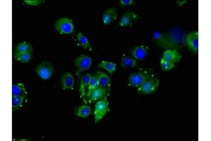 Immunofluorescent analysis of MCF-7 cells using ABIN7149653 at dilution of 1:100 and Alexa Fluor 488-congugated AffiniPure Goat Anti-Rabbit IgG(H+L) (DLL4 抗体  (AA 44-345))