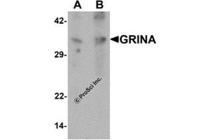 Western Blotting (WB) image for anti-Glutamate Receptor, Ionotropic, N-Methyl D-Aspartate-Associated Protein 1 (Glutamate Binding) (GRINA) antibody (ABIN1077413) (GRINA 抗体)