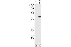 Western blot analysis of STK4 / MST1 antibody and 293 cell lysate either nontransfected (Lane 1) or transiently transfected with the STK4 gene (2). (STK4 抗体  (AA 385-415))