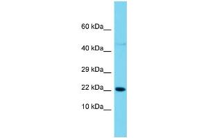 Host: Rabbit  Target Name: Snx12  Sample Tissue: Rat Pancreas lysates  Antibody Dilution: 1. (SNX12 抗体  (C-Term))