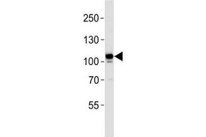 MER antibody western blot analysis in Jurkat lysate. (MERTK 抗体)