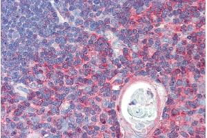 ABIN570663 (5µg/ml) staining of paraffin embedded Human Thymus. (TXK 抗体  (C-Term))