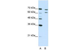 WB Suggested Anti-CPSF3 Antibody Titration:  5.