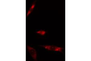 ABIN6274876 staining Hela cells by IF/ICC. (ATPAF2 抗体)