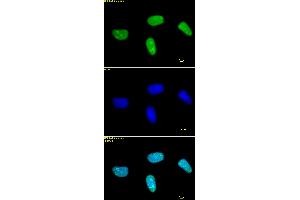 Histone H3 dimethyl Lys27 antibody tested by immunofluorescence. (Histone 3 抗体  (2meLys27))
