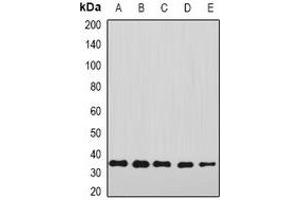 Western blot analysis of Annexin A4 expression in A549 (A), HepG2 (B), mouse liver (C), mouse lung (D), rat kidney (E) whole cell lysates. (Annexin IV 抗体)