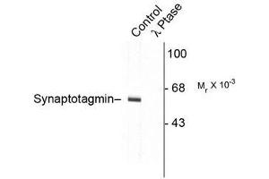 Image no. 1 for anti-Synaptotagmin I (SYT1) (pThr202) antibody (ABIN372724)
