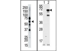 Image no. 1 for anti-Epsin 2 (EPN2) (N-Term) antibody (ABIN357623) (Epsin 2 抗体  (N-Term))