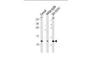 All lanes : Anti-CKS2 Antibody (N-Term) at 1:2000 dilution Lane 1: Caco2 whole cell lysate Lane 2: RI 8226 whole cell lysate Lane 3: SH-SY5Y whole cell lysate Lysates/proteins at 20 μg per lane. (CKS2 抗体  (AA 6-40))