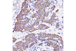 Immunohistochemistry of paraffin-embedded rat testis using UBL3 antibody (ABIN6131930, ABIN6149849, ABIN6149850 and ABIN6220468) at dilution of 1:100 (40x lens). (UBL3 抗体  (AA 1-117))