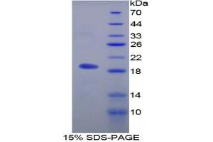 SDS-PAGE analysis of Rat MFAP5 Protein. (MFAP5 蛋白)