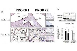 PROKR1 and PROKR2 protein expression in pacental-tissue, umbilical cord and in isolated HPECs and HUVECs (A) Immnohystoschemistry of chorionic vili and ombilical cord sections using antibodies to PROKR1 and PROKR2. (Prokineticin Receptor 2 抗体  (N-Term))