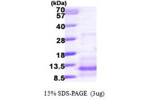 SDS-PAGE (SDS) image for Chemokine (C-C Motif) Ligand 20 (CCL20) (AA 27-96) protein (His tag) (ABIN667875) (CCL20 Protein (AA 27-96) (His tag))