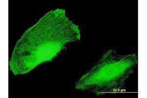 Immunofluorescence of purified MaxPab antibody to C10orf81 on HeLa cell. (C10orf81 抗体  (AA 1-282))