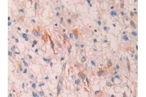 Immunohistochemistry (IHC) image for anti-Lysyl Oxidase-Like 4 (LOXL4) (AA 399-552) antibody (ABIN7437674)