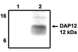 Image no. 1 for anti-TYRO Protein tyrosine Kinase Binding Protein (TYROBP) antibody (ABIN201720) (TYROBP 抗体)