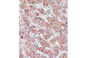 Immunohistochemistry (IHC) image for anti-UDP-GlcNAc:betaGal beta-1,3-N-Acetylglucosaminyltransferase 3 (B3GNT3) (AA 120-240) antibody (ABIN7271204)