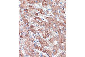Immunohistochemistry of paraffin-embedded Human liver using B3GNT3 Rabbit pAb (ABIN7271204) at dilution of 1:100 (40x lens). (B3GNT3 抗体  (AA 120-240))