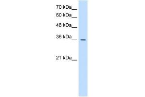 TRPM5 antibody used at 0. (TRPM5 抗体  (N-Term))