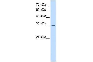 Western Blotting (WB) image for anti-Transient Receptor Potential Cation Channel, Subfamily M, Member 5 (TRPM5) (N-Term) antibody (ABIN633719)