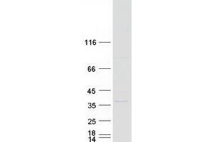 Western Blotting (WB) image for Sulfotransferase Family, Cytosolic, 1A, Phenol-Preferring, Member 3 (SULT1A3) (Transcript Variant 1) protein (Myc-DYKDDDDK Tag) (ABIN2732931)