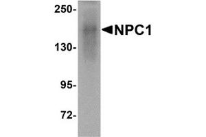 Western Blotting (WB) image for anti-Niemann-Pick Disease, Type C1 (NPC1) (C-Term) antibody (ABIN1030549) (NPC1 抗体  (C-Term))