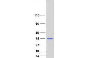 Western Blotting (WB) image for Family with Sequence Similarity 221, Member A (FAM221A) (Transcript Variant 2) protein (Myc-DYKDDDDK Tag) (ABIN2720774)