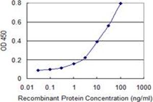 Detection limit for recombinant GST tagged ULK2 is 0. (ULK2 抗体  (AA 743-843))