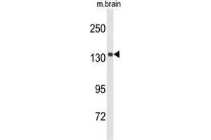 Western Blotting (WB) image for anti-Ubiquitously Transcribed Tetratricopeptide Repeat Gene, Y-Linked (UTY) (AA 1254-1284), (C-Term) antibody (ABIN955496)