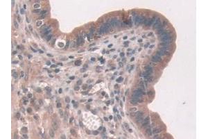 Immunohistochemistry (IHC) image for anti-Asporin (ASPN) (AA 16-373) antibody (ABIN7434827)