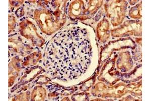 Immunohistochemistry of paraffin-embedded human kidney tissue using ABIN7169873 at dilution of 1:100 (SNRPD1 抗体  (AA 1-119))
