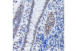 Immunohistochemistry of paraffin-embedded human appendix using SF3B1 Rabbit mAb (ABIN7270542) at dilution of 1:100 (40x lens). (SF3B1 抗体)