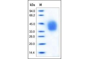 SDS-PAGE (SDS) image for Interleukin 4 Receptor (IL4R) (AA 26-232) (Active) protein (His tag) (ABIN2181320)