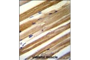 C antibody (C-term) (ABIN654725 and ABIN2844413) immunohistochemistry analysis in formalin fixed and paraffin embedded human skeletal muscle followed by peroxidase conjugation of the secondary antibody and DAB staining. (CU070 Protein 抗体  (C-Term))
