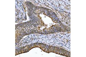 IHC analysis of THAP11 using anti-THAP11 antibody (ABIN7599230). (THAP11 抗体  (AA 1-294))