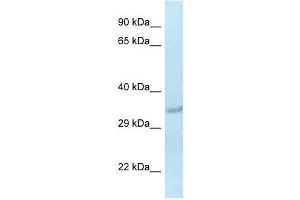 Western Blot showing Sult1c2 antibody used at a concentration of 1. (SULT1C2 抗体  (Middle Region))