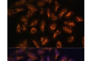 Immunofluorescence analysis of U-2 OS cells using SSTR2 Polyclonal Antibody at dilution of 1:100 (40x lens). (SSTR2 抗体)
