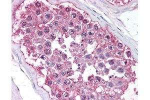 Anti-DAX1 antibody IHC of human testis. (NR0B1 抗体  (Ligand Binding Domain))