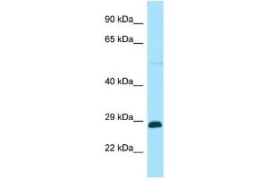Western Blotting (WB) image for anti-RAB GTPase Activating Protein 1-Like (RABGAP1L) (Middle Region) antibody (ABIN2790497) (RABGAP1L 抗体  (Middle Region))