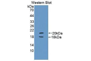 Western blot analysis of the recombinant protein. (PYGL 抗体  (AA 603-750))