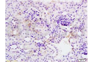 Formalin-fixed and mouse kidney tissue labeled with Anti-SOD2 Polyclonal Antibody, Unconjugated (ABIN737361) at 1:200 followed by conjugation to the secondary antibody and DAB staining (SOD2 抗体  (AA 41-78))