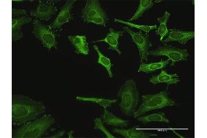 Immunofluorescence of purified MaxPab antibody to ZYX on HeLa cell. (ZYX 抗体  (AA 1-572))