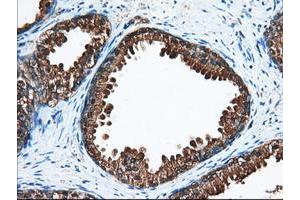 Image no. 9 for anti-Acetyl-CoA Acetyltransferase 2 (ACAT2) antibody (ABIN1496404)