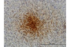 Immunostaining (ISt) image for anti-Myosin, Light Chain 1, Alkali, Skeletal, Fast (MYL1) (AA 1-80) antibody (ABIN518149)
