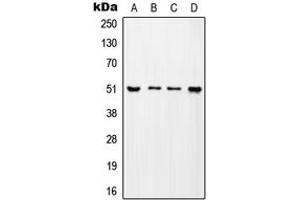 Western blot analysis of ADA2A expression in MCF7 (A), SP2/0 (B), H9C2 (C), mouse testis (D) whole cell lysates. (TADA2L 抗体  (Center))
