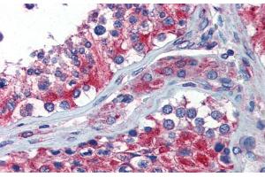 Immunohistochemistry with Human Testis lysate tissue at an antibody concentration of 5. (NPY1R 抗体  (Middle Region))