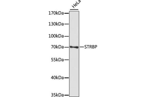 STRBP Antikörper  (AA 40-190)